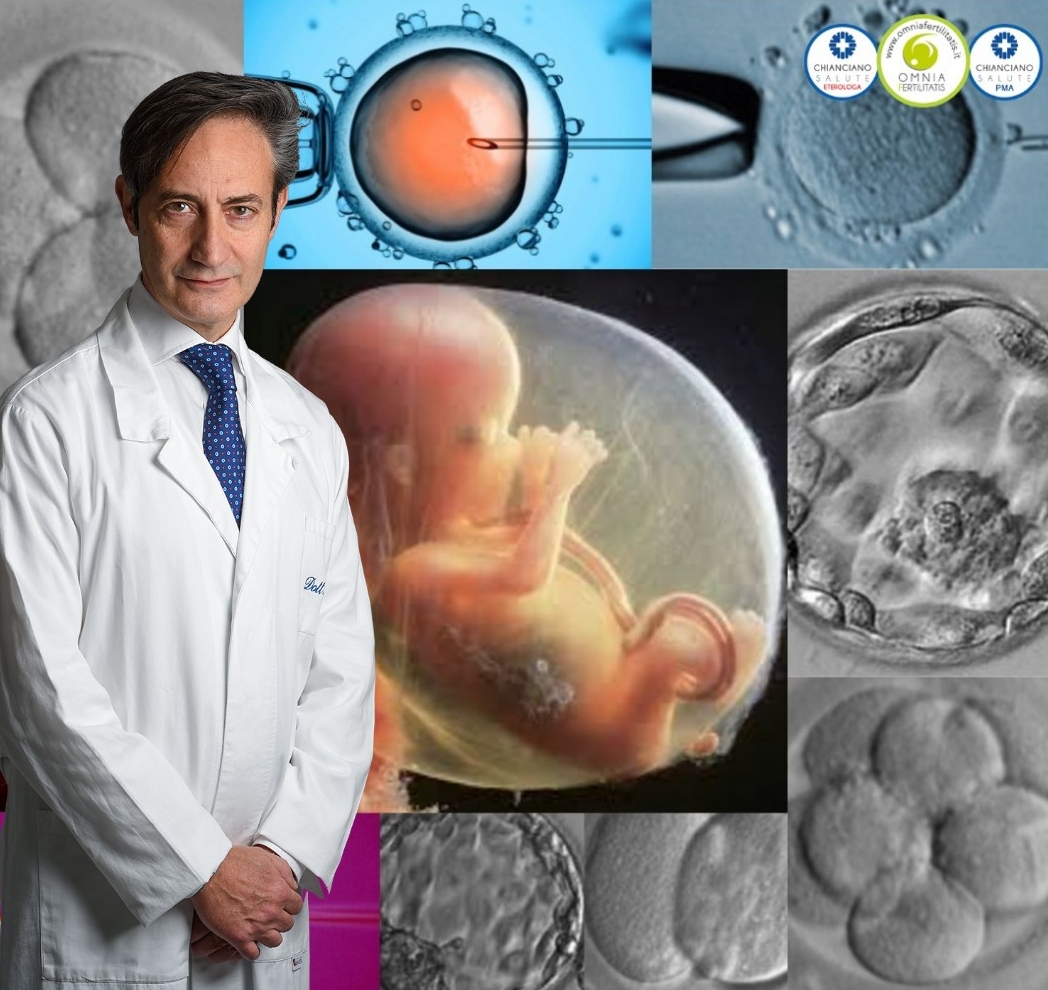 Meglio il transfert da embrione o Blastocisti? Risponde il dot. Alfonso Maria Irollo